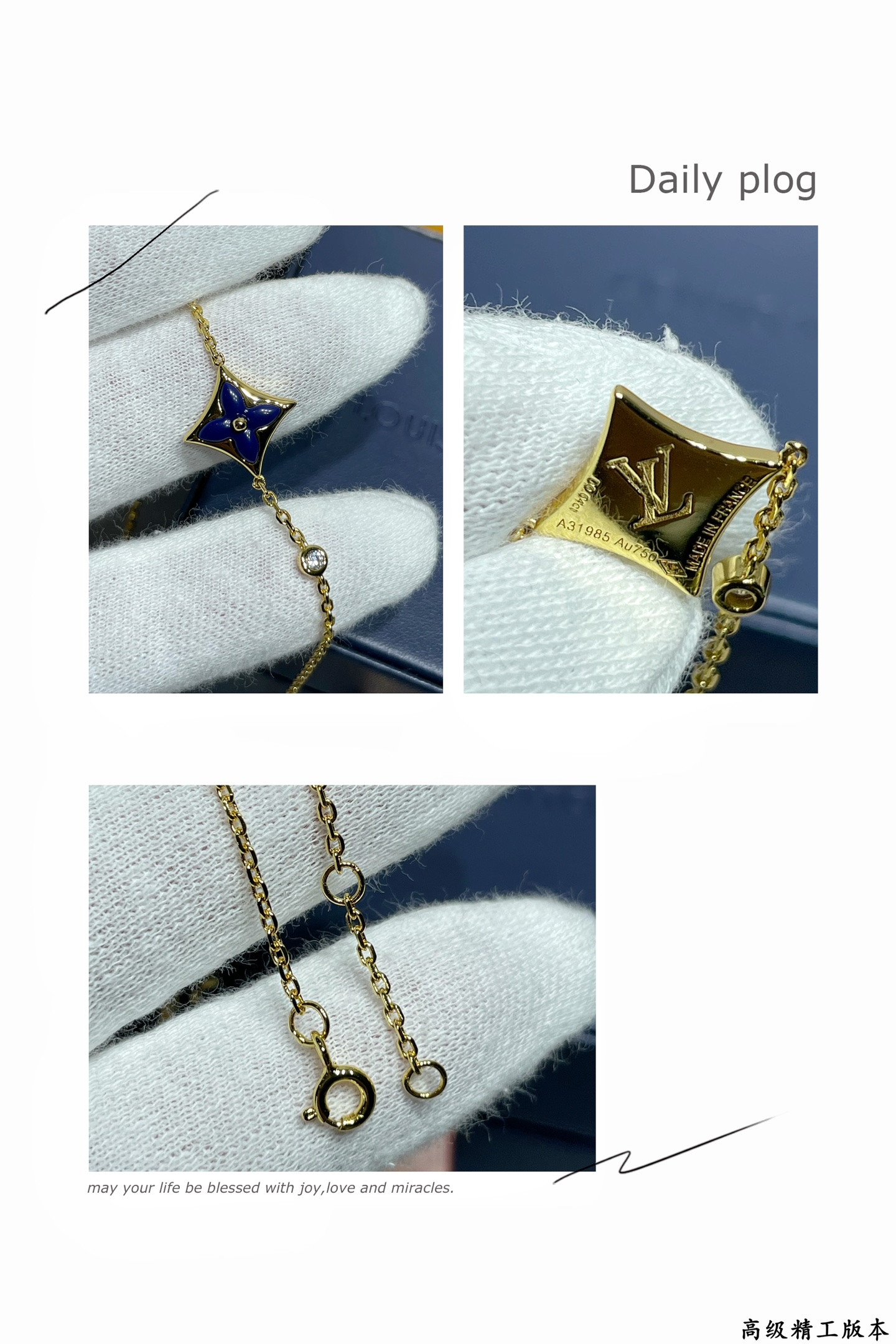 l0*is V*t0n bracelet